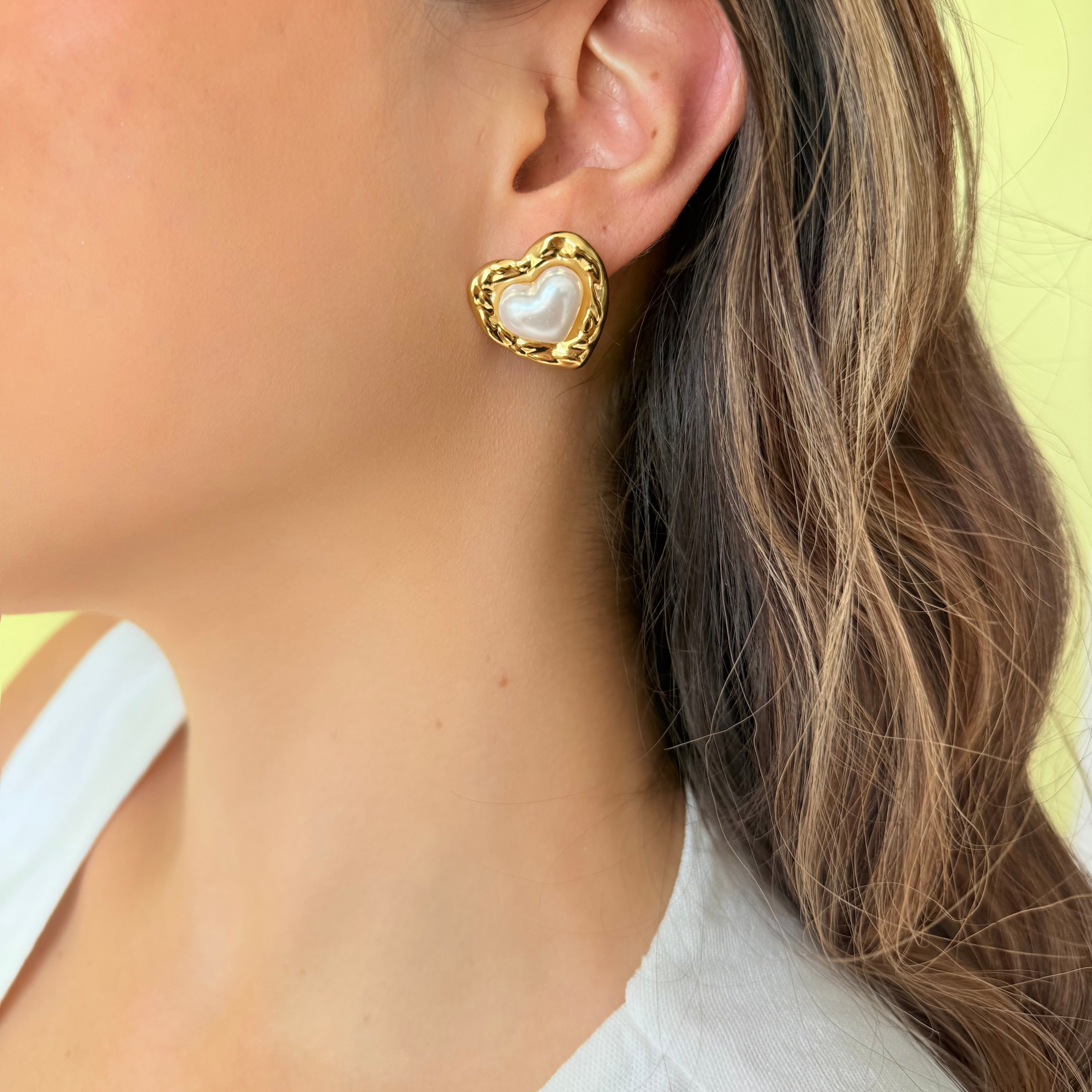 Aretes LU