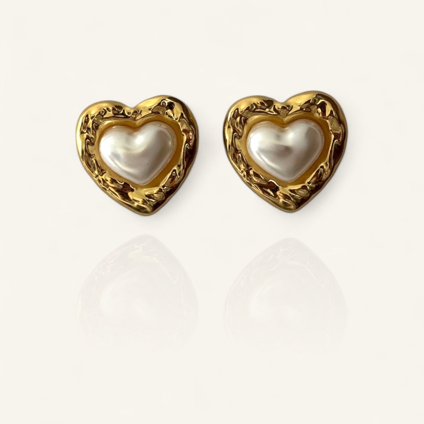 Aretes LU